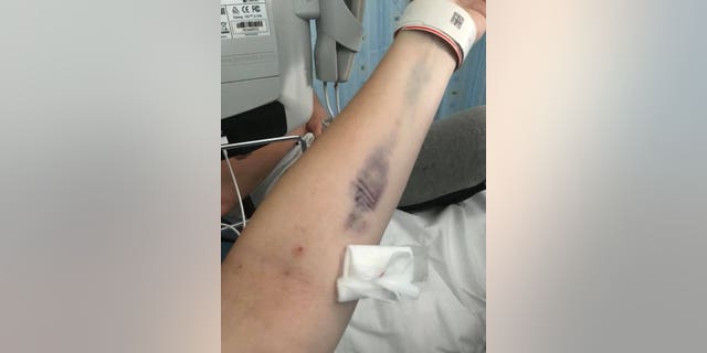 Paige Balding was diagnosed with sepsis after she gave birth to her son Hunter Jae July last year. A tribunal found medics failed to realize medical swab was left inside her causing her to contract sepsis.