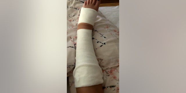 O'Keeffe is now casted and will be evaluated for potential surgery.