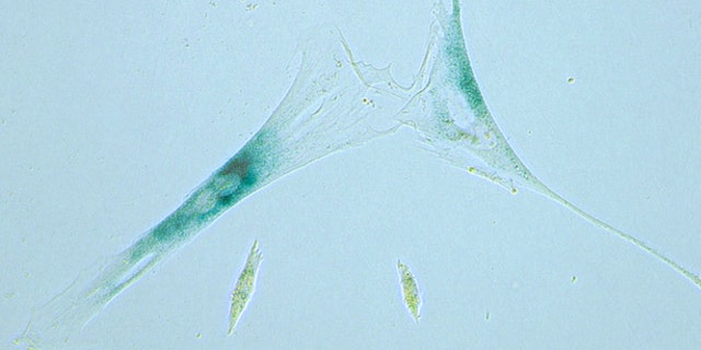 "Zombie" cells start out normal but then encounter a stress, like damage to their DNA or viral infection. At that point, a cell can choose to die or become a zombie, which means they stop going through their normal cycle of activities.
