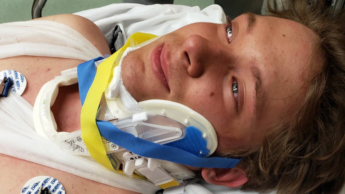 Ben Foster, 17, survived a 50-foot-fall from a bluff in a Missouri state park Sunday morning.
