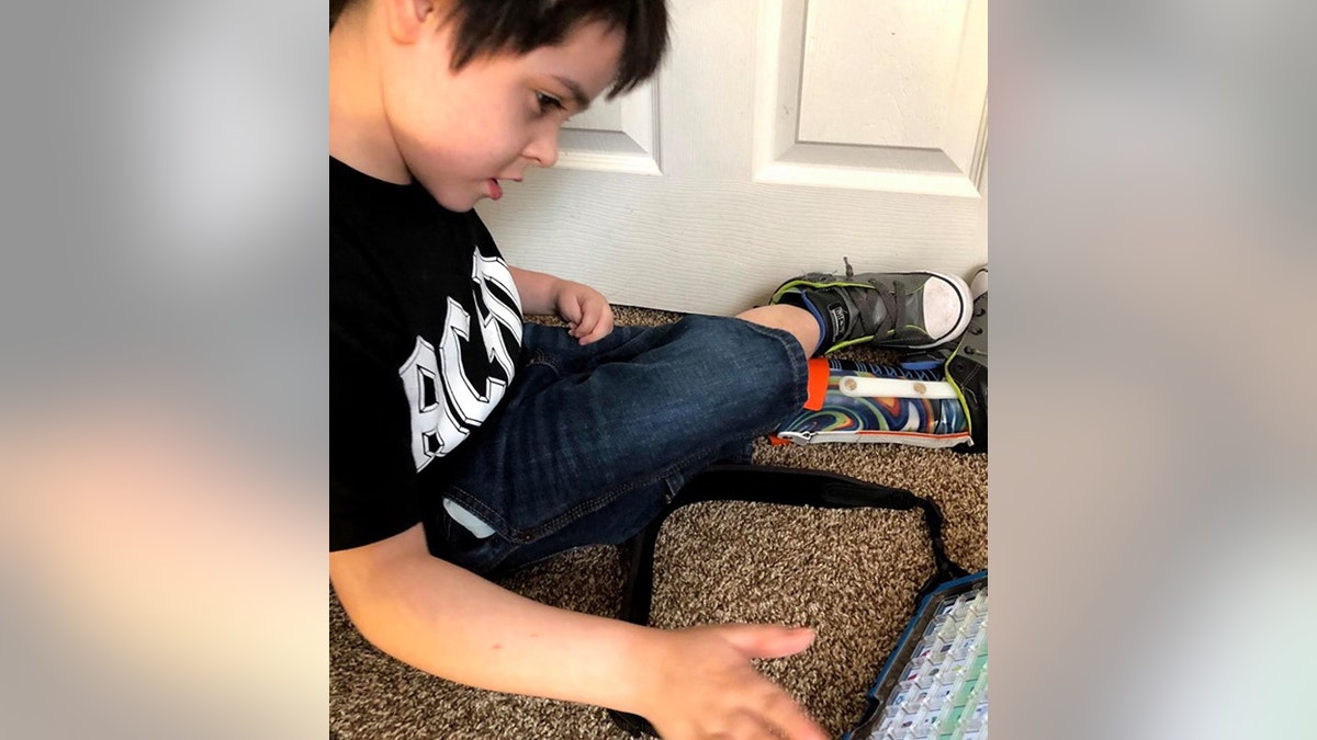 In addition to his speech impairment, Kylar also has a visual impairment that his mom says he is adjusting to.
