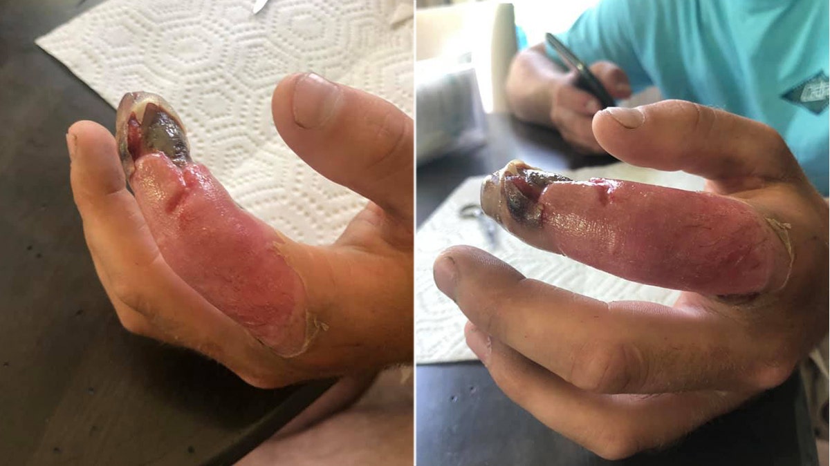 McGee said that he didn't suspect a snake bite because he didn't hear a loud rattle.