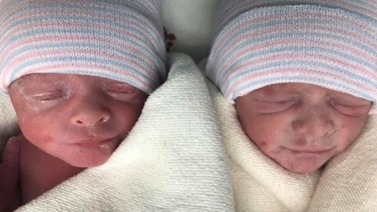 The twins, pictured above, are still hospitalized, according to the family.