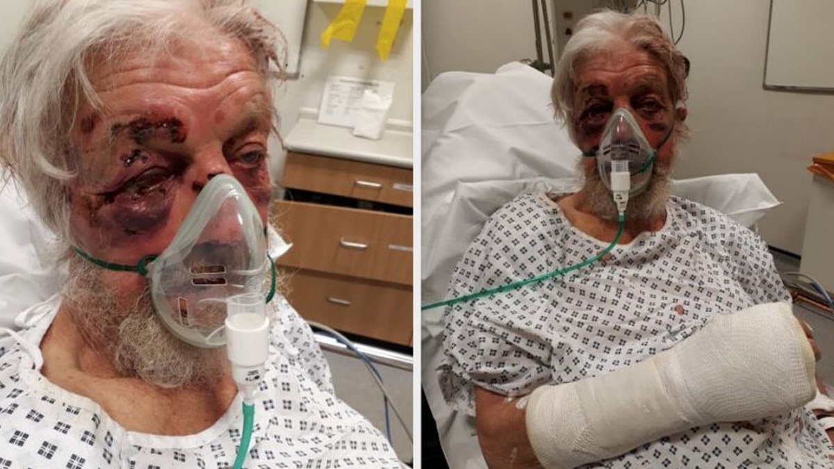 Paul Eva, 80, sustained serious injuries after being struck in what police described as a "nonsensical" attack in April.