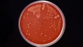 Outbreak of rare bacterial infection kills 12 in the UK, officials say