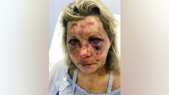 Delaware woman sues luxury resort in Dominican Republic for $3 million over alleged attack