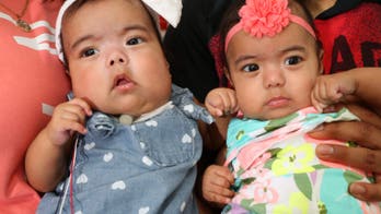 Doctors partially deliver baby with mass on neck to help protect unborn twin