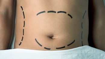 Utah resident dies after weight-loss surgery in Mexico, 7 others sickened: health officials