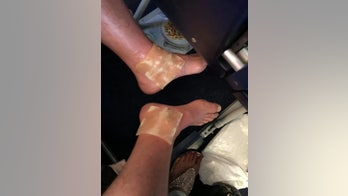 Ryanair passenger allegedly suffers severe burns after flight attendant drops boiling hot water on him