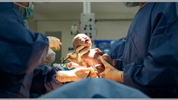 Brazilian women reportedly spend thousands of dollars on C-section parties