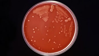 Outbreak of rare bacterial infection kills 12 in the UK, officials say