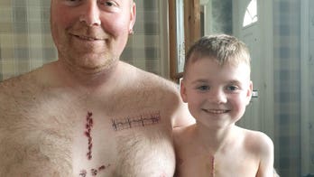 Dad's tattoo matches son's life-saving heart surgery scar