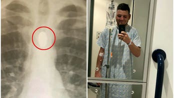 Man who landed in hospital after swallowing coin at party swears off stunt: 'Dad thinks I'm an idiot'