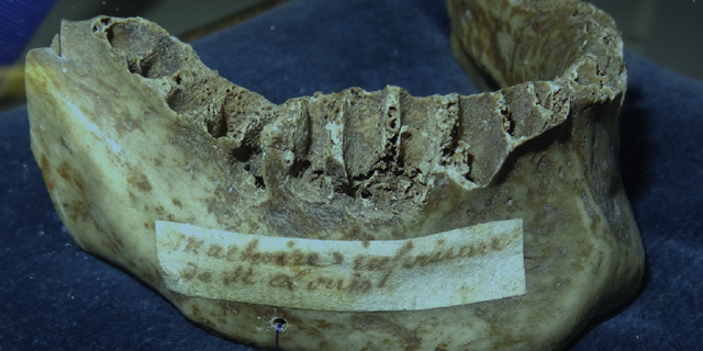 An image of the jaw shows an 18th Century parchment attached identifying it as belonging to Louis IX.