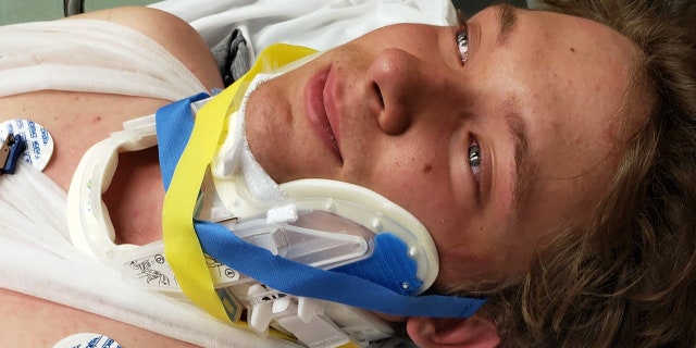 Ben Foster, 17, survived a 50-foot-fall from a bluff in a Missouri state park Sunday morning.