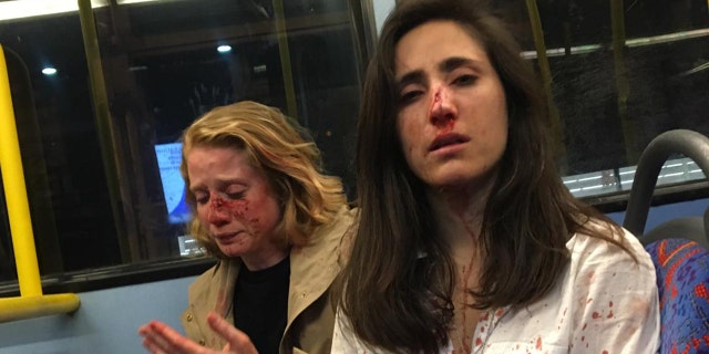 Fox news today: Geymonat said they were punched and robbed after refusing to kiss. They were treated at a hospital for facial injuries following the attack.