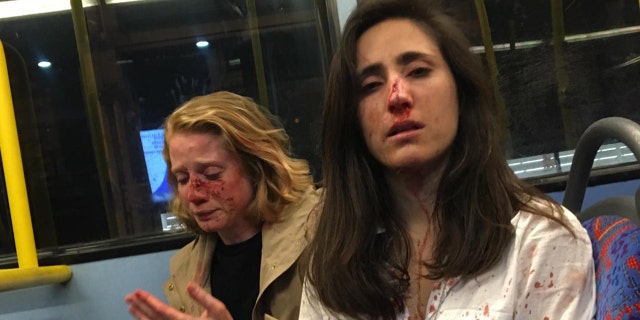 Geymonat said they were punched and robbed after refusing to kiss. They were treated at a hospital for facial injuries following the attack.