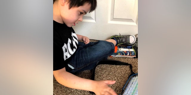 In addition to his speech impairment, Kylar also has a visual impairment that his mom says he is adjusting to.