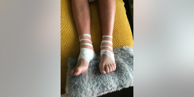 McNab's horrified partner, Tonina Ciantar, claims staff failed to administer appropriate first aid and left him blistering as she watched on helplessly.