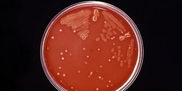 This photo from the Tennessee Department of Health shows invasive Group A streptococcus (IGAS) that has been responsible for at least 12 deaths in the United Kingdom.