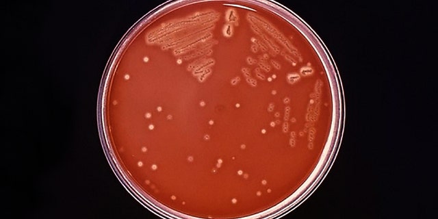 This photo from the Tennessee Department of Health shows invasive Group A streptococcus (IGAS) that has been responsible for at least 12 deaths in the United Kingdom.