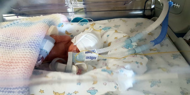 Sienna weight just 2 pounds, 4 ounces at birth.
