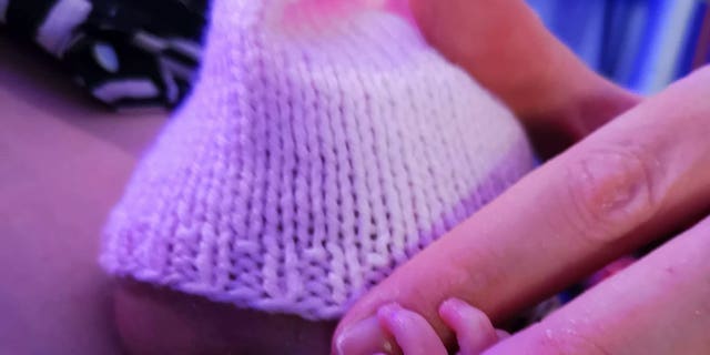 Ivy was innate to relatives Laura and Dave after they had suffered 13 miscarriages.