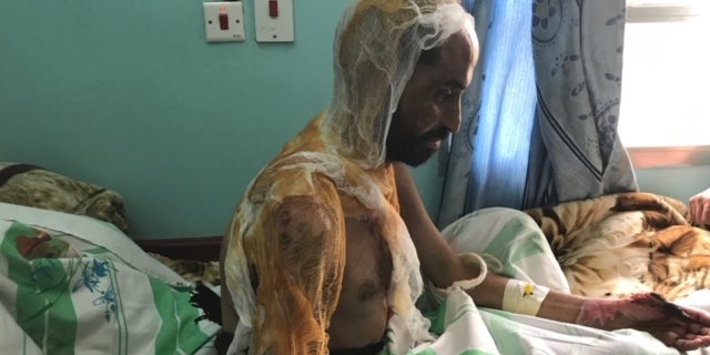 A civilian left for dead near his home in Sana'a, Yemen