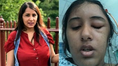 Woman who thought itchy eyes were allergy symptom diagnosed with brain tumor