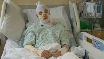 Washington man severely burned after saving 8-year-old niece from fire says 'I'd run back in there and do it again'