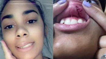 Subway employee punched in the face by customer: 'I blacked out for a few seconds'