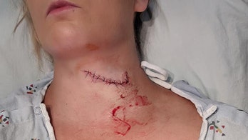 South Dakota woman survives freak lawn mower accident that left her neck sliced open