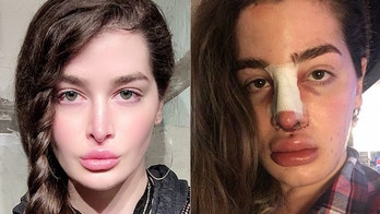 Plastic surgery 'addict' who had ribs removed says family fears procedures will kill her