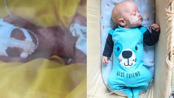 Baby born weighing less than 2 pounds defies odds