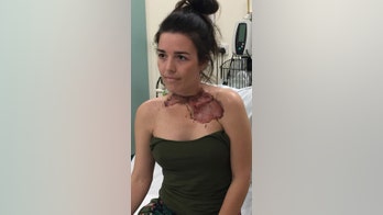 Woman says 'sore throat' led to near-fatal infection that left her with hole in neck