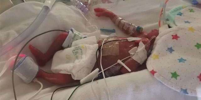 The family's fundraising page said Jaden will likely remain in the NICU until his original November due date