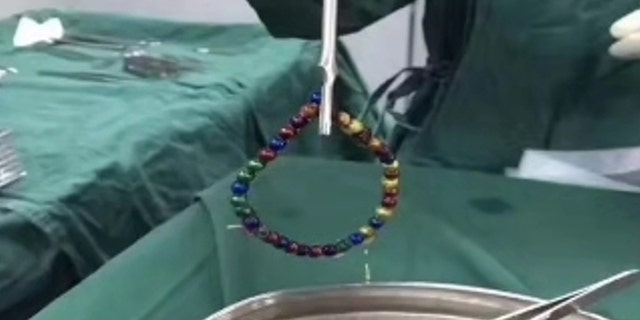 The magnets were removed in a 1-hour surgery, but had already caused two holes in her intestine.