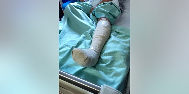 Elle a déclaré qu'elle faisait maintenant face à une convalescence de plusieurs mois et qu'elle avertissait les autres de la sécurité des barbecues.