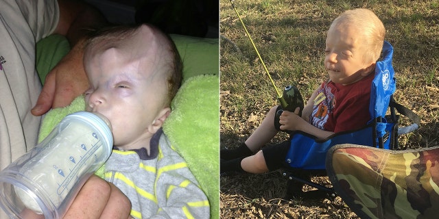 He's undergone 36 procedures already and is set for another on his spine.