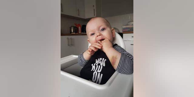 Jack Fearns, now 2, has a rare blood condition called hemophilia.