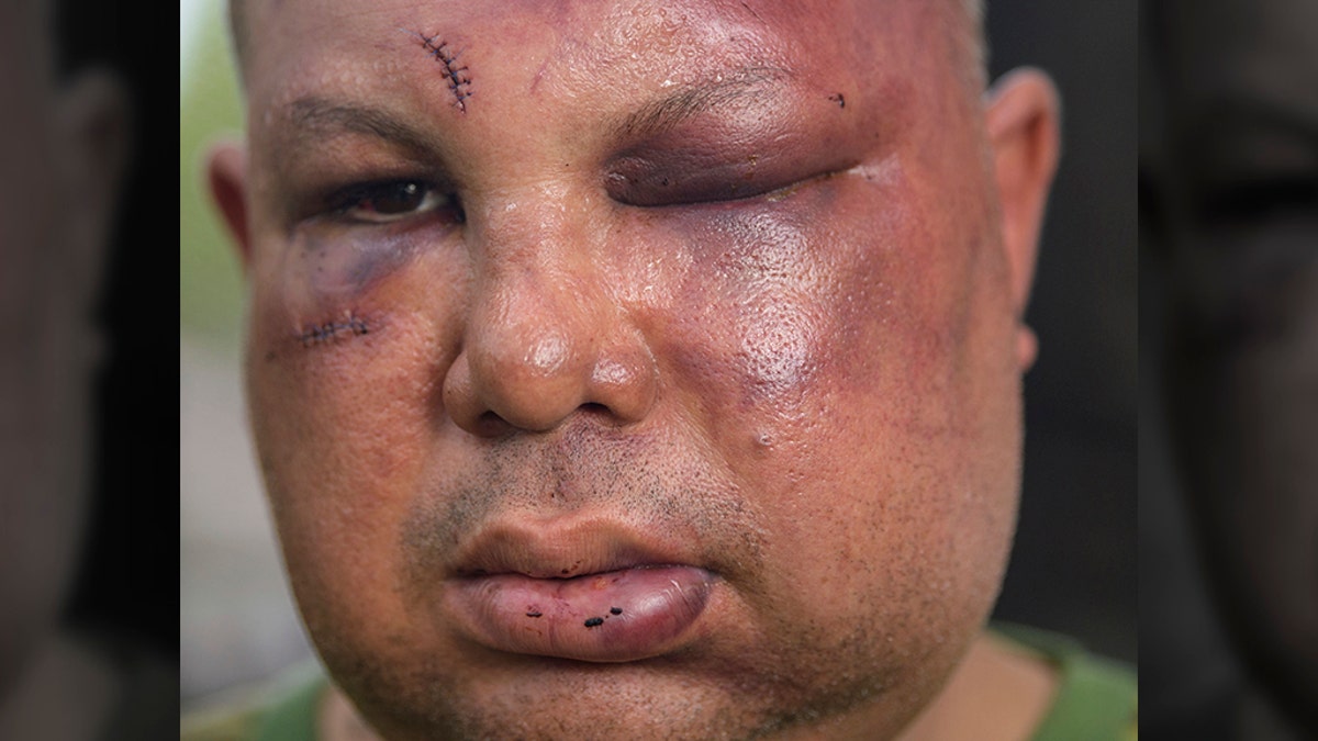 This 2018 photo shows beating victim Jorge Gomez. (Matthew Hinton/The Times-Picayune/The New Orleans Advocate via AP)