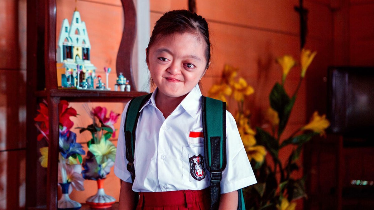 Karunia was born with Apert Syndrome, a rare congenital condition that left her without fingers and toes, but, despite her condition and bullying from her peers, she is full of joy and changing the way her community cares for others.