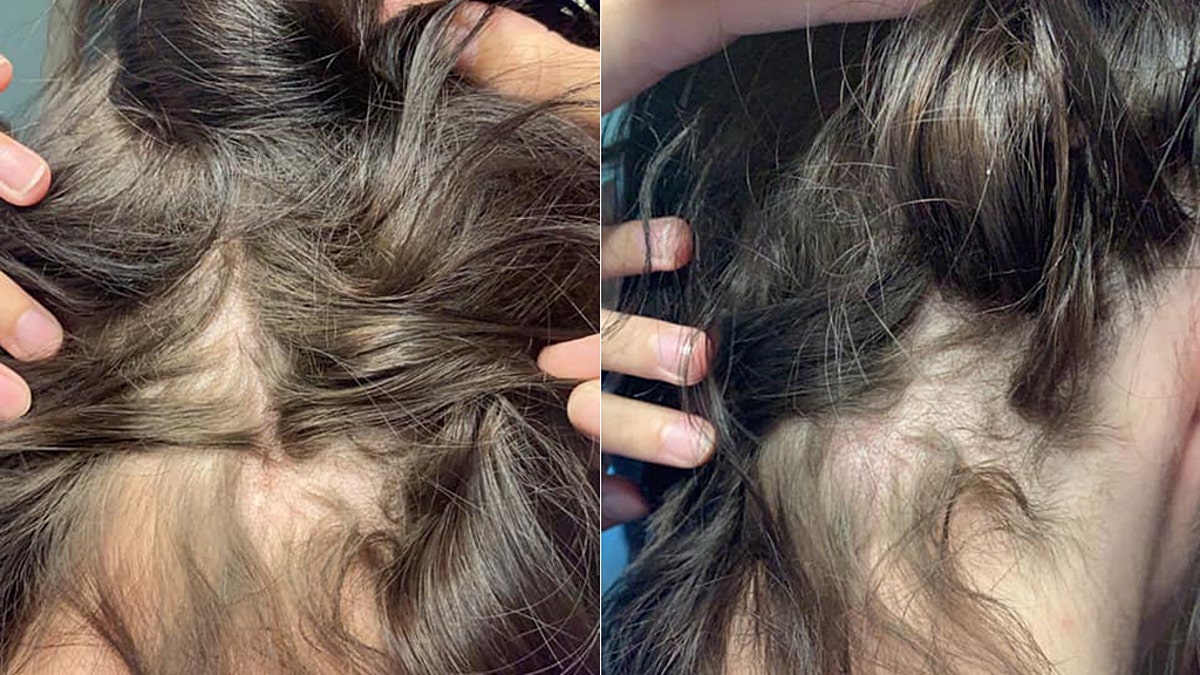 Woman claims Pantene conditioner, possibly contaminated with Nair, made her  hair fall out | Fox News