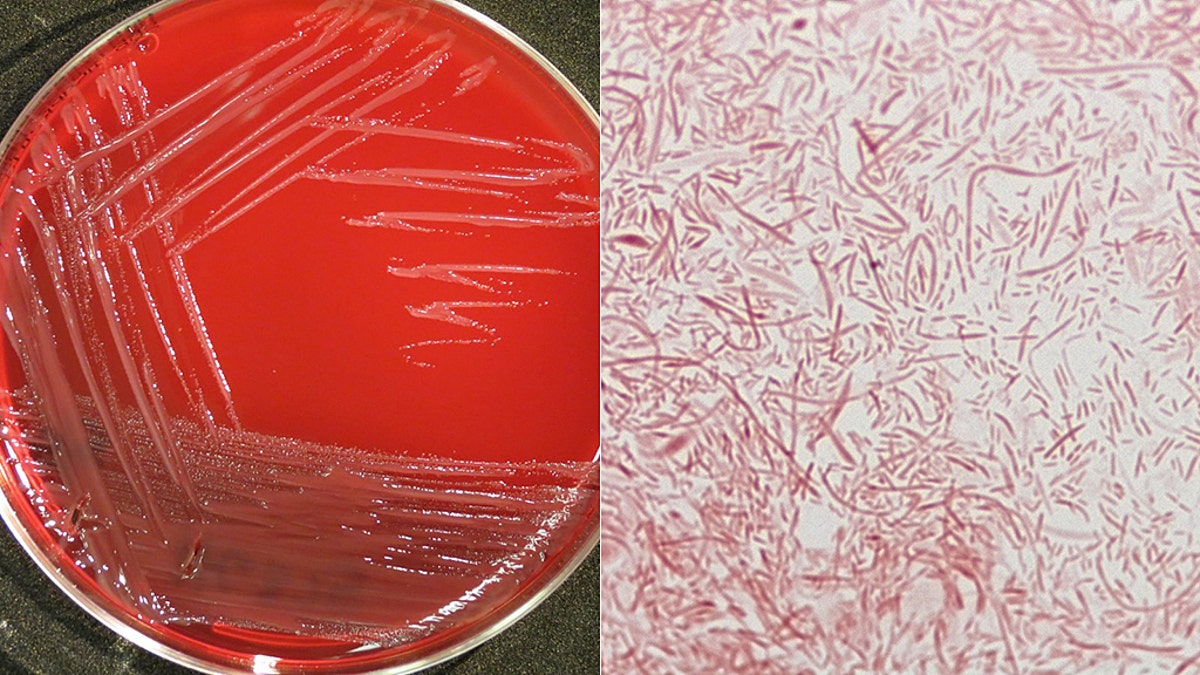 Capnocytophaga, normal bacteria found in the mouths of people, dogs and cats. Exposure through contact usually is not serious, but in rare cases, can lead to serious infections, including sepsis.