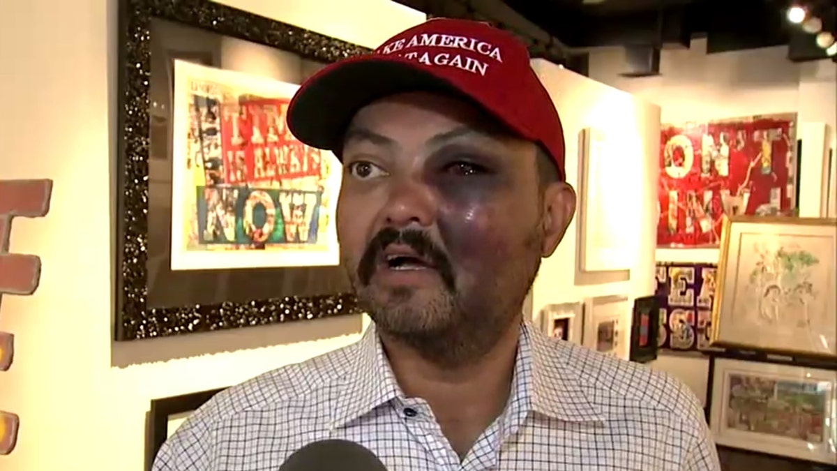 Jahangir Turan claims he was assualted Tuesday night for wearing a “Make American Great Again" hat that he had purchased earlier that day.