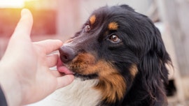 Ohio Woman With Dog Lick Infection Has Legs Parts Of Arms