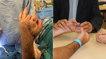 Surgeons attach man's hand to groin in effort to prevent amputation