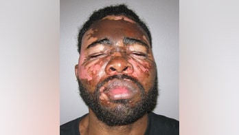 Alabama woman severely burned alleged burglar's face by throwing pot of hot grease on him: report