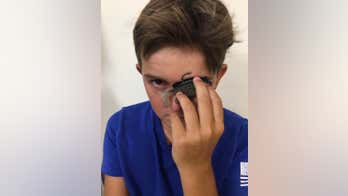 Fishing accident leaves 11-year-old with hook in his eyelid