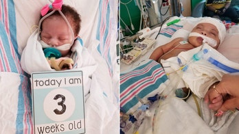 Miracle baby born with severe heart disease, taken off life support months ago, about to celebrate first birthday